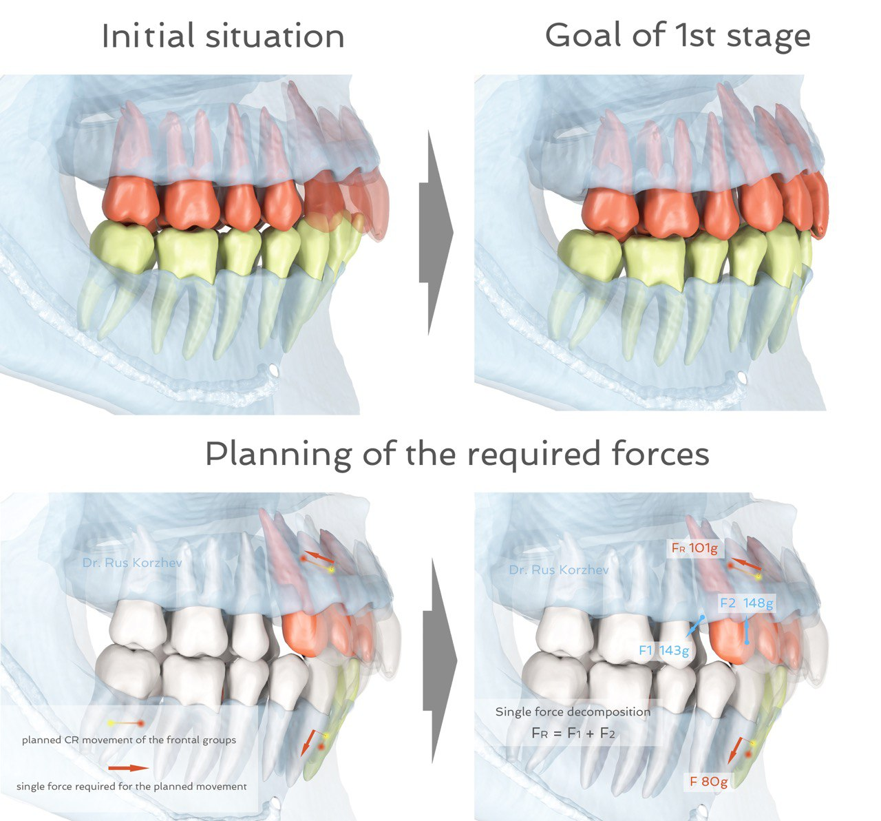 Force planning biomechanics visualization