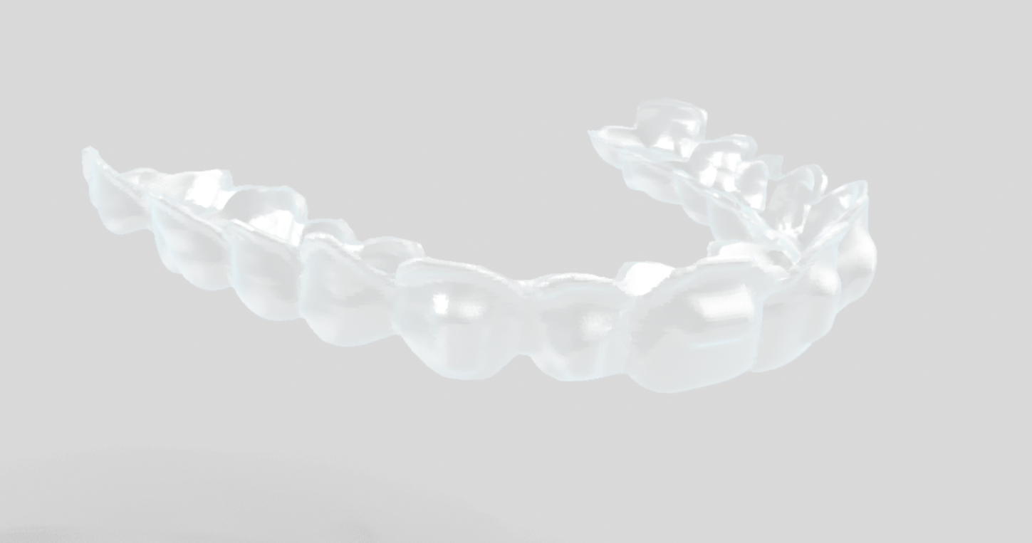 Clear aligner finishing
